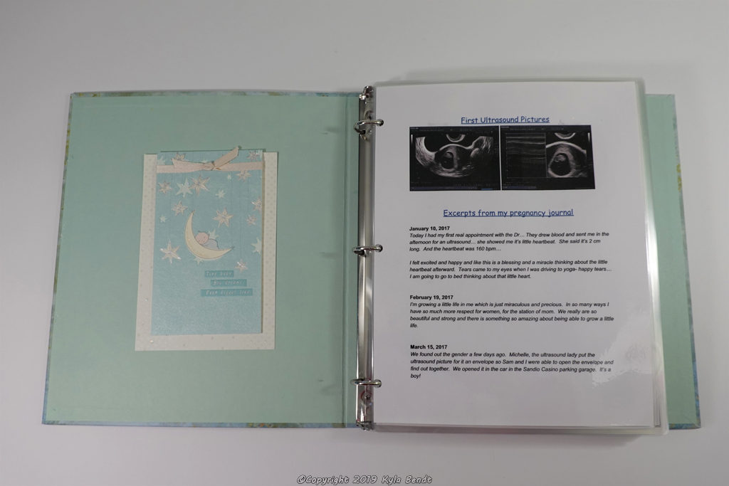 Ultrasound baby photo album -5x7 Ready to ship