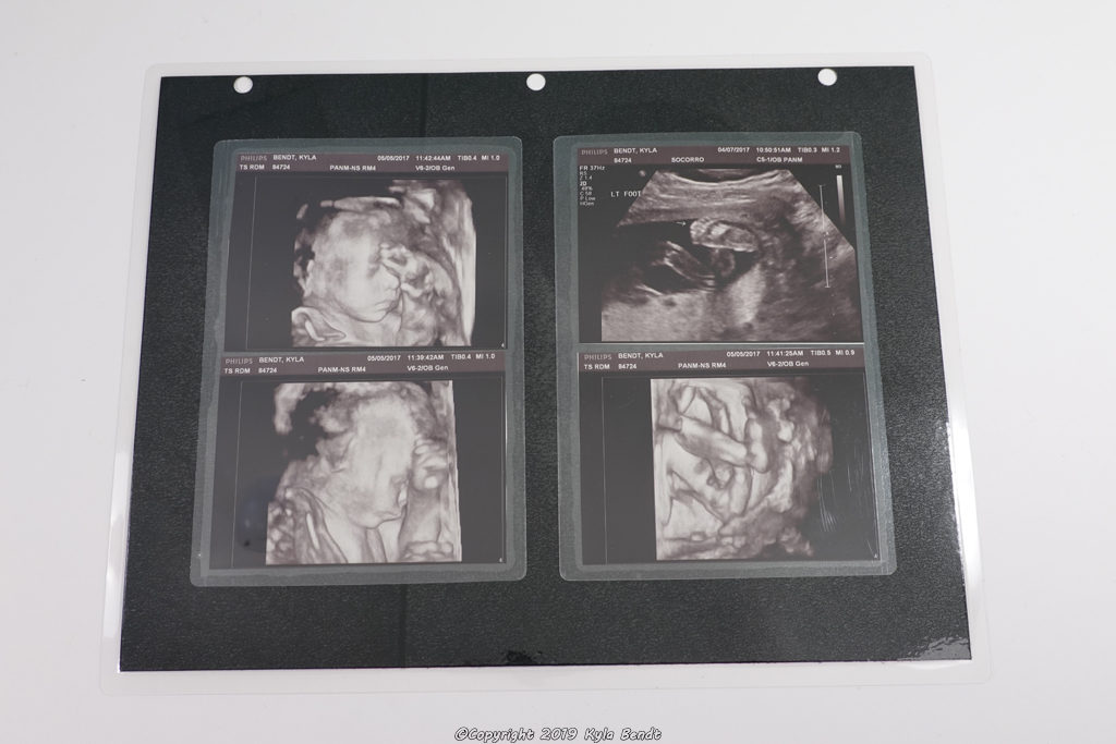 laminated baby book page - ultrasound photos